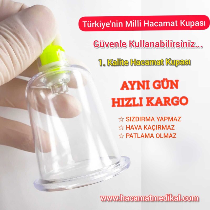 Hacamat Kupası Satış Yerleri